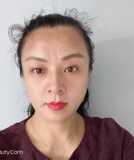 Book an Appointment with Jingmin Zhang for Acupuncture